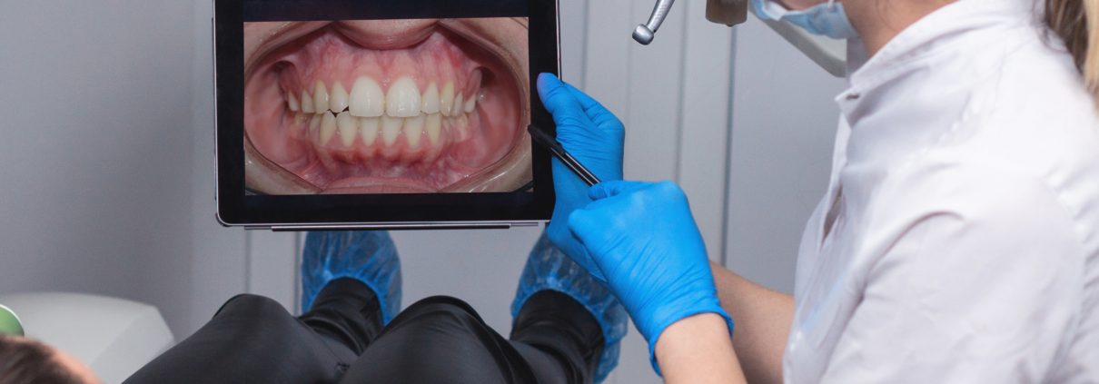 Occhiuzzi_Fotografías digitales para ortodoncia