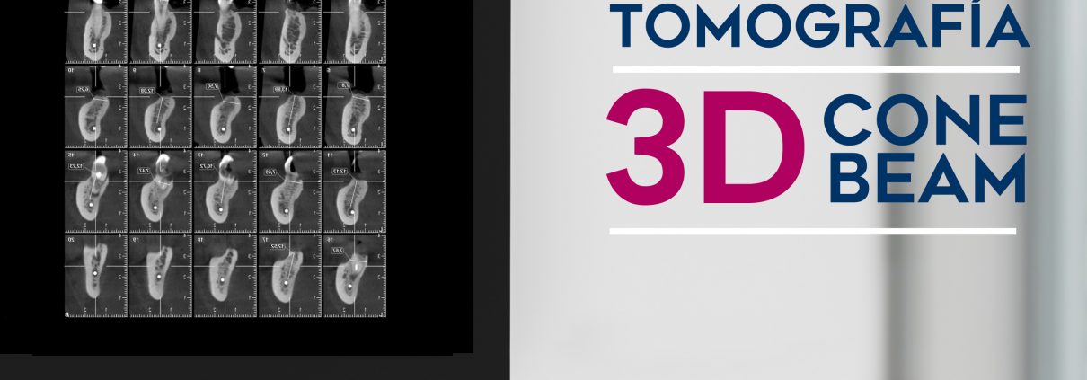 Tomografia 3d Cone Beam Occhiuzzi