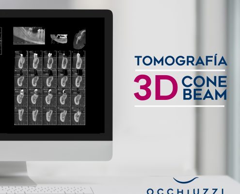 Tomografia 3d Cone Beam Occhiuzzi