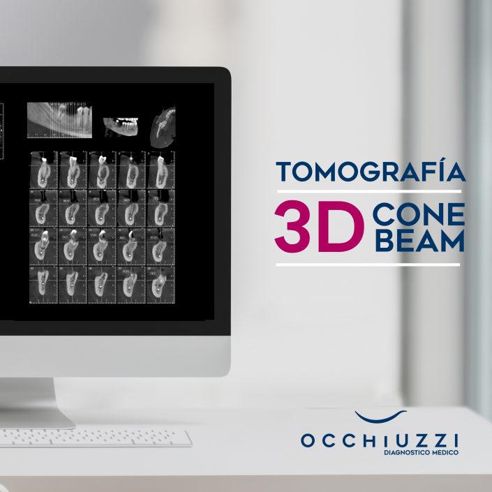 Tomografia 3d Cone Beam Occhiuzzi